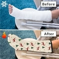 thumbnail image 7 of COEQINE Christmas Deer Leg Cast Cover 2 Pcs Size L Below The Knee Leg Cast Sleeve Breathable Cast and Bandage Protector Decorative Leg Cast Cover Christmas Gifts for Kids Girls, 7 of 7