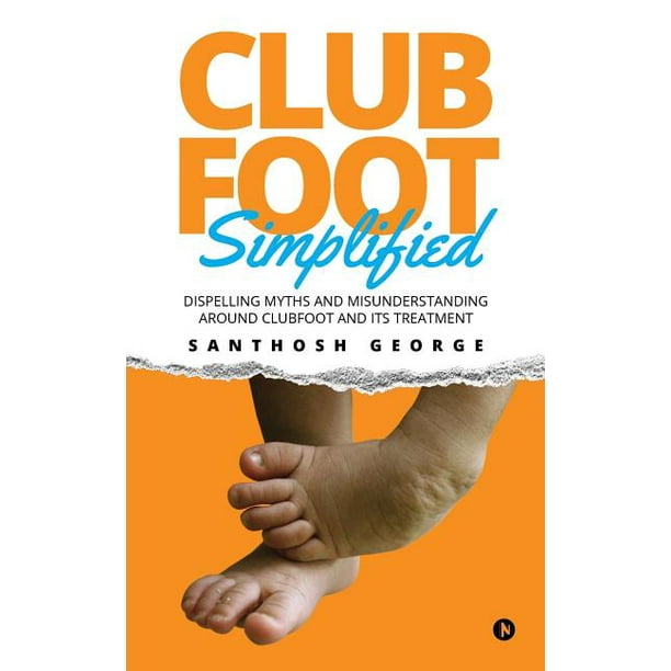 Clubfoot Simplified Dispelling Myths And Misunderstanding Around Clubfoot And Its Treatment Paperback Walmart Com Walmart Com