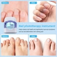 Mieauty UV Light Nail Fungus Cleaner, Fungal Renewal Laser Treatment