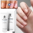 thumbnail image 2 of 3pcs Fungal Nail Treatments Gel for Toenail Fingernail, Quick Absorption Nail Strengthening Cream, Nails Care Supplies, 2 of 5