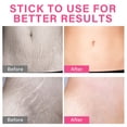 thumbnail image 5 of Stretch Mark Cream for Women, Hydrating Belly Cream for Pregnancy, 5 of 8