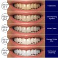 thumbnail image 5 of Pasta Blanqueadora de Dientes 3D Blanqueadora Blanqueadora Amarilla 14pcs JAMW Sencillez, 5 of 5