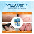thumbnail image 3 of Hermon Powerful Antifungal Ringworm Cream - Treatment for Ringworm, Jock Itch, Eczema, Tinea Versicolor, Athlete's Foot  - 100ml, 3 of 9