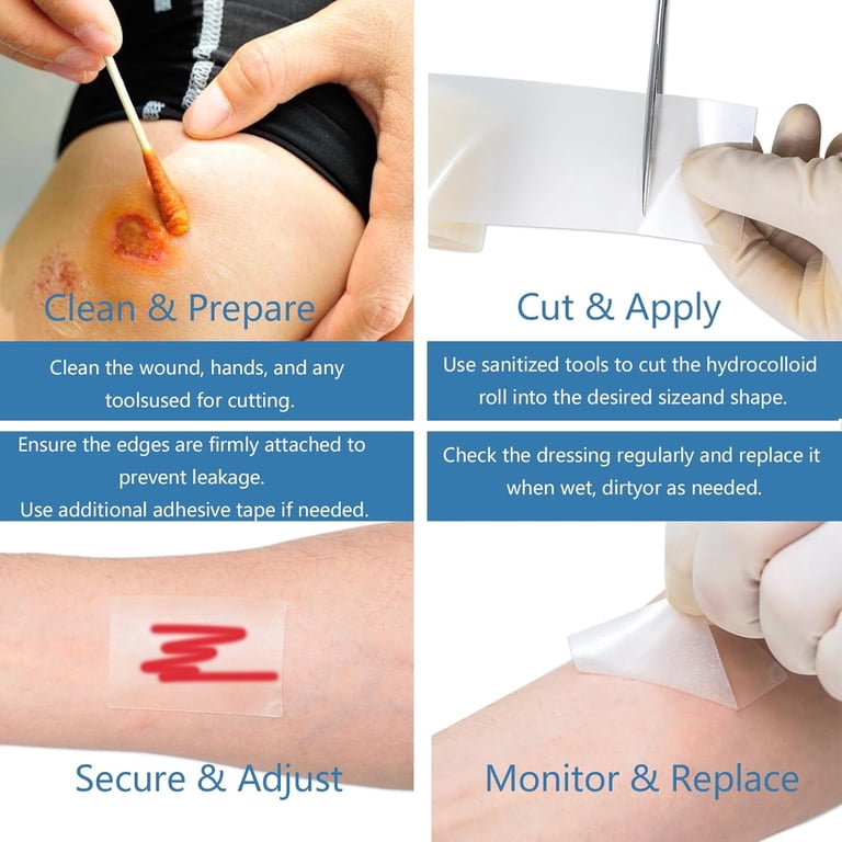 can you cut hydrocolloid dressing Hydrocolloid Bordered Dressing Vive Health