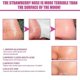 thumbnail image 3 of Jaysuing Aloe Vera Nose Patch Blackhead Remover Set Aloe Vera Gel 30g + Paper 40PCS + Cotton Swab 10PCS, 3 of 4