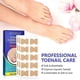 thumbnail image 3 of Nail Correction Stickers Toenail Care Paronychia Anti-Infection Repair Patch, 3 of 5