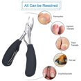 thumbnail image 4 of Cortaúñas, Tijeras De Uñas Profesionales, Cortaúñas Para Uñas De Los Pies Y Uñas Gruesas Y Encarnadas, Cortaúñas De Acero Inoxidable Con G Antideslizante, 4 of 5