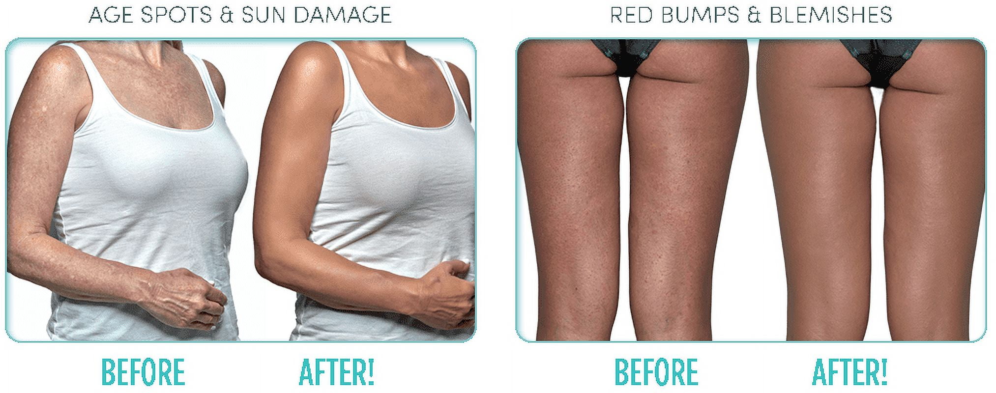 Ideal Conceal Light to Medium Instant Body Enhancer As Seen On Tv