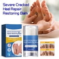 thumbnail image 4 of Cracked Feet Cream, 2pcs 40g Moisturizing Cracked Heel Repair Cream  For Home Use For All Skin Types, 4 of 8