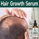 thumbnail image 2 of Aceite de biotina para el crecimiento rápido del cabello, suero para el crecimiento rápido del cabello, tratamiento para adelgazamiento del cabello, líquido para el crecimiento del cabello, antipérdid, 2 of 5
