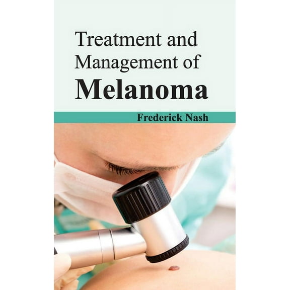 Treatment and Management of Melanoma (Hardcover)