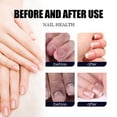 thumbnail image 5 of 30ml Anti-Fungal Nail Spray, Deep Repair & Natural Ingredients Nail Care Spray For Men & Women, 5 of 5