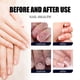 thumbnail image 5 of 30ml Anti-Fungal Nail Spray, Deep Repair & Natural Ingredients Nail Care Spray For Men & Women, 5 of 5