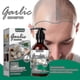 thumbnail image 2 of Jaysuing Garlic Shampoo Cleansing Anti-itch Anti-dandruff Shampoo Hair Growth Anti-fall Shampoo | |, 2 of 5