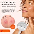 thumbnail image 2 of Parches para el acné ZitSticka Killa Extra Strength, 20 unidades, 2 of 8