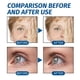 thumbnail image 4 of Crema Antiambiente y Retinol onlyliua 50 G Reduce Color Reafirma Hidrata Rejuvenecimiento Piel, 4 of 7