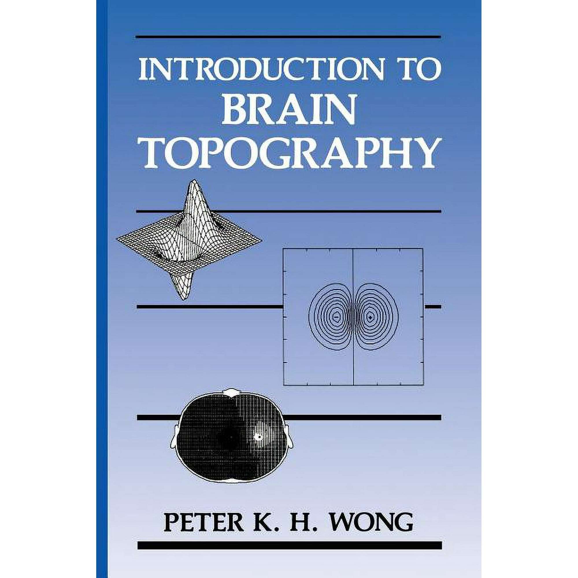 Introduction to Brain Topography (Paperback)
