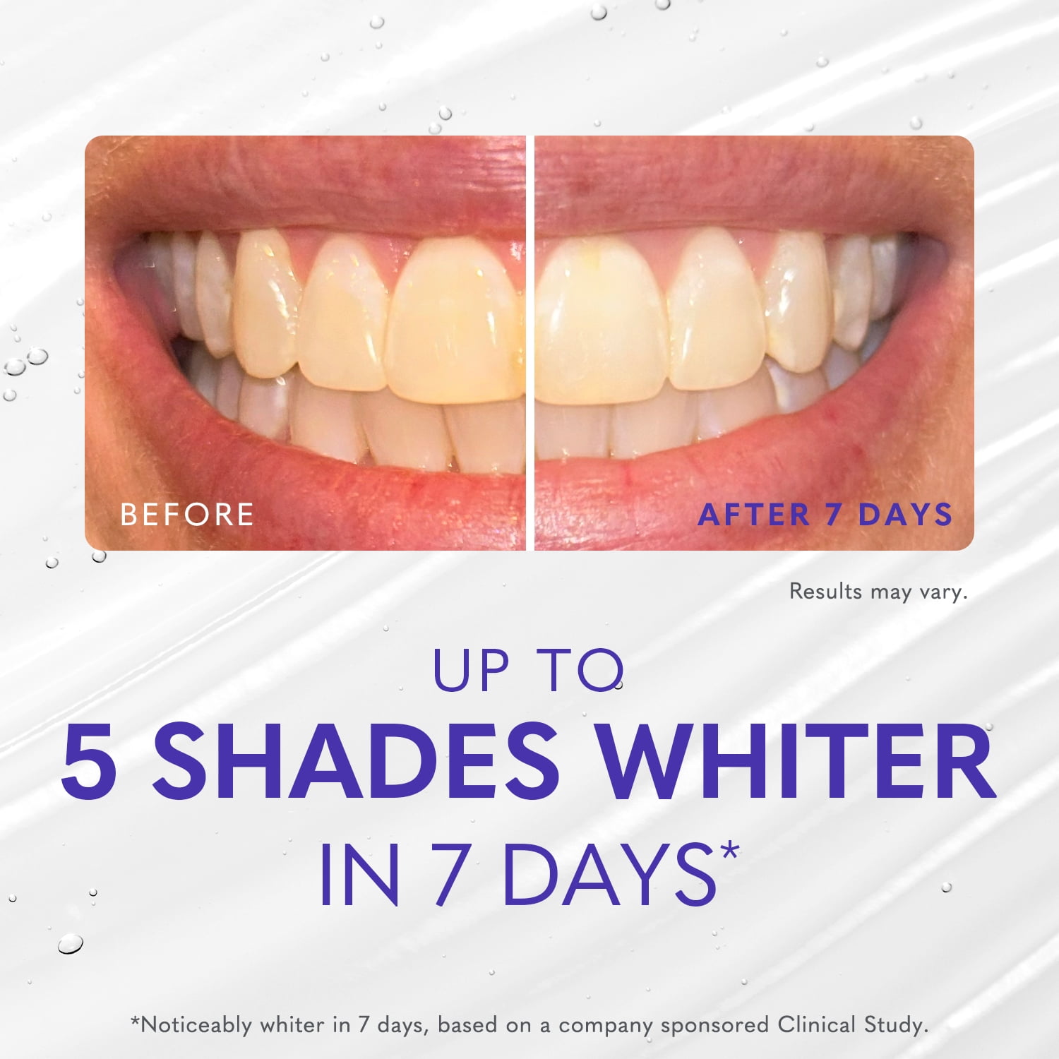 Smileactives Tooth Whitening & Brightening Duo, Dentist Quality Pro Gel & Pen, 30 Day Supply
