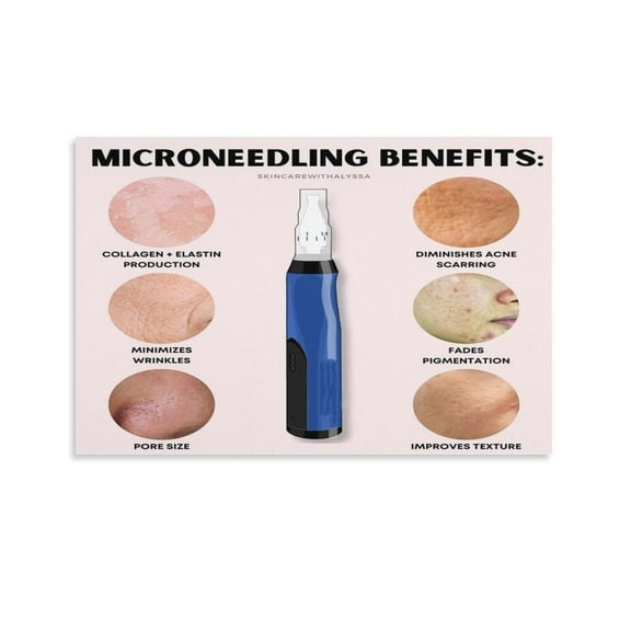 Microneedling Benefits Poster Canvas Wall Art Posters For Room Aesthetic And Decor Poster For Bedroom Living Room Bathroom Kitchen Office Decor poster