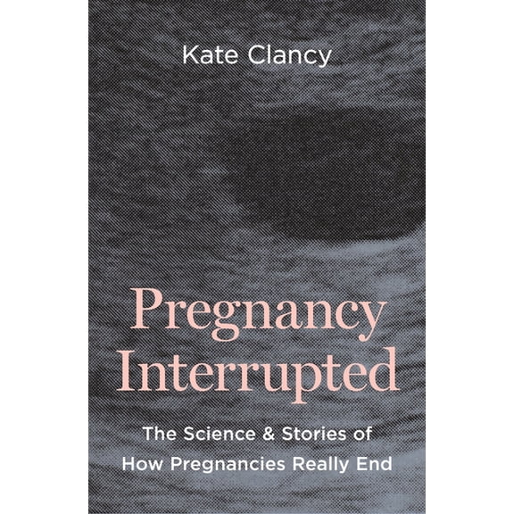 Pregnancy Interrupted: The Science and Stories of How Pregnancies Really End, (Hardcover)