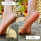 thumbnail image 5 of Piedra de afeitar para pies, limpiador de uñas de acero inoxidable, kit para el cuidado de los pies, exfoliante para pies, afeitadora de uñas, portátil, plegable, de metal, para uso doméstico, 5 of 7