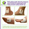 thumbnail image 2 of U Shaped Felt Callus Pads - Adhesive Foot Pads That Protect Calluses from Rubbing On Shoes - Skived 1/4" - 50 Pack, 2 of 5