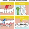thumbnail image 4 of HOLIV 5pcs L Shaped Interdental Brushes for Effective Tooth Care，Portable L Shaped Interdental Brushes(Yellow), 4 of 7