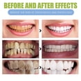 thumbnail image 3 of Gel probiótico de regeneración dental, para todo tipo de problemas bucales, especialmente la regeneración dental, 3 of 5