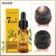 thumbnail image 2 of Ginger Germinal Hair Growth Serum Hairdressing Oil Hair Relief 7 Day Regrow, 2 of 4