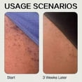 thumbnail image 4 of Roller Ball Ingrown Hair Serum Roll-On - Soothes & Calms Irritated Skin on Face, Armpits & Bikini Areas 25-26, 4 of 5