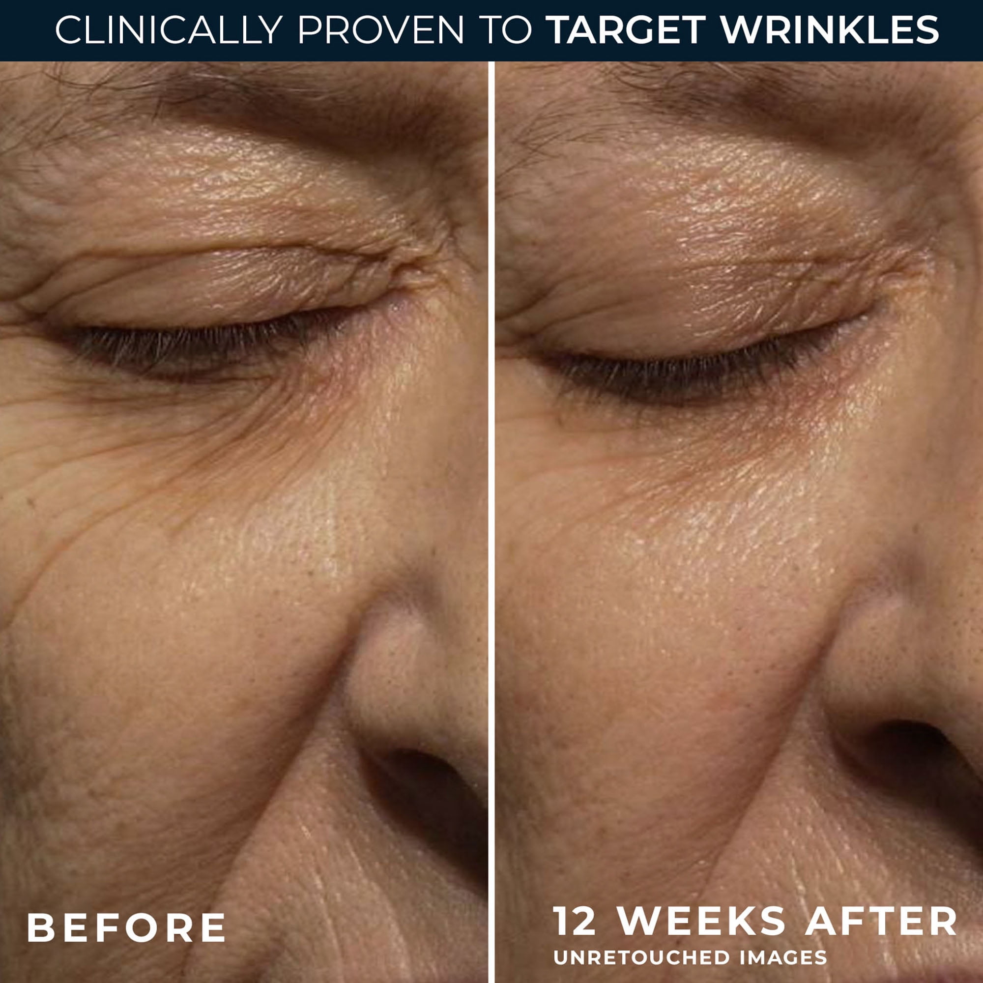 RoC Skincare - Retinol Correxion®️ - Deep Wrinkle Night Cream - Works While You Sleep (30ml)