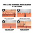 thumbnail image 4 of Jaysuing Face Lipper Tightness Lipper Face French Ribb Fine Wrinkle Skin Sag Anti-Wrinkle Face Lipper - 1Pcs, 4 of 4