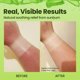 thumbnail image 5 of Borghese Occhi Ristorativo Eye Creme - Gel crema para ojos reafirmante e hidratante con antioxidantes de ácido hialurónico y resveratrol para todo tipo de piel, 5 of 5