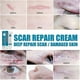 thumbnail image 2 of Crema reparadora de cicatrices, Gel para eliminar cicatrices de acné, estrías que se desvanecen, manchas de acné, tratamiento de cicatrices quirúrgicas, suero suave para el cuidado de la piel del cuer, 2 of 3