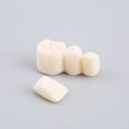 thumbnail image 3 of Modèle de Dent Amovible, Prothèse Fixe sur Implant pour les Bureaux, 3 of 8