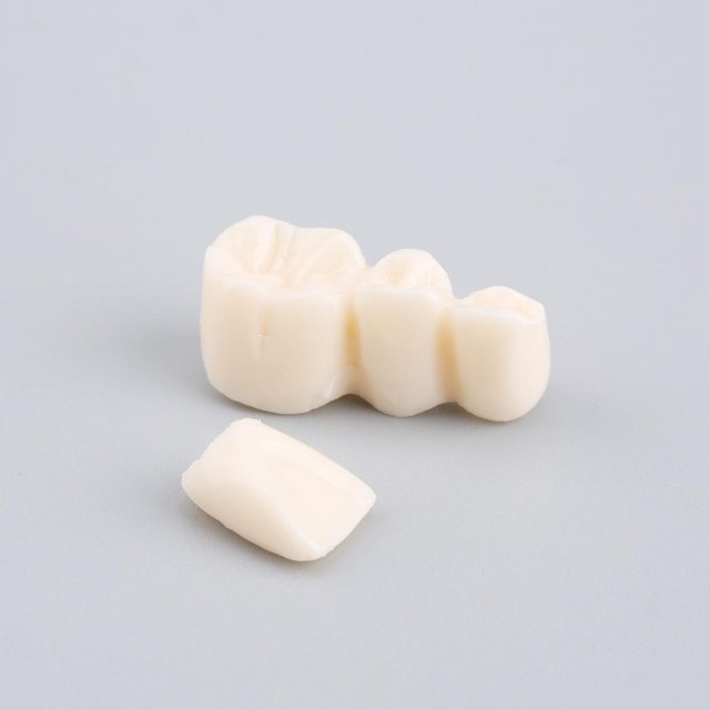 Disease Teaching Model Adult Typodont Teeth Demonstration Implant Educational Tool for Schools Programs