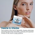 thumbnail image 5 of 2025 Seborrheic Dermatitis Cream, Anti Fungal Shampoo, Scalp Treatment for Psoriasis, Folliculitis, Dry Scalp, Anti-Itch, Sooth_c*, 5 of 5