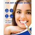 thumbnail image 6 of MySmile Premium 35%CP Teeth Whitening Pen with 28-LED Light, Teeth Whitening Kit, 4 Gold Whitening Gel Pen Refills, Enamel Safe, Remove 10 Years of Stains, 6 of 8