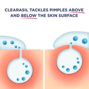 clearasil ultra 5in1 exfoliating wash, 6.78 oz. (pack of 2)