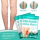 thumbnail image 1 of 16 piezas de parches para el tratamiento de venas varicosas, parches para venas varicosas, parches para venas varicosas, 1 of 5