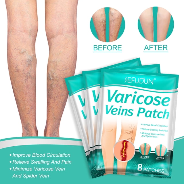 Paquete de 16 parches de tratamiento de venas varicosas para la salud de las venas, parche de venas varicosas, alivio del dolor de piernas, vasculitis, venas varicosas de araña, mejora la circulación TUNC Sencillez