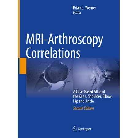 UPC: 9783030947880 | Mri-Arthroscopy Correlations: A Case-Based Atlas of the Knee Shoulder Elbow Hip and Ankle (Hardcover)