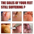 thumbnail image 2 of RAGUPEL Foot Corn Removal Gel,Liquid Corn and Callus Remover,Corn Remover Gel for Feet,Corn Removers for Toes Extra Strength,10ml (3pcs), 2 of 4