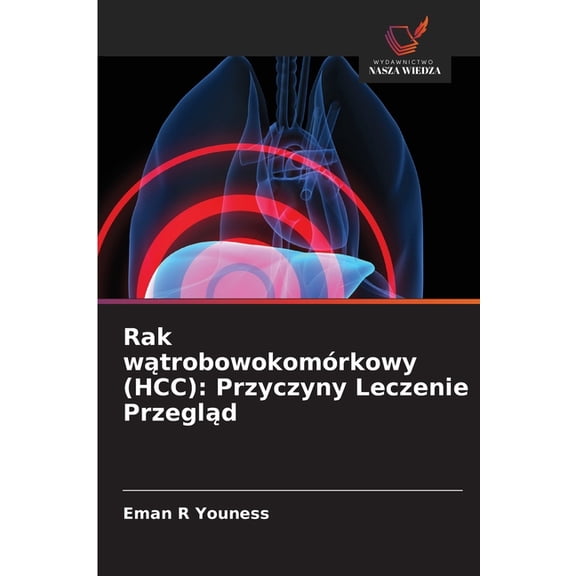 Rak wątrobowokomÃ³rkowy (HCC): Przyczyny Leczenie Przegląd, (Paperback)