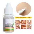 thumbnail image 2 of Eliminador De Lunares, 10Ml, Eliminación De Verrugas, Líquido Altamente Eficiente, Cara Suave, Seguro Para La Piel, Eliminador De Verrugas, Etiqueta De Piel Efectiva De Corto Tiempo Serendint CE004266-00, 2 of 6