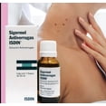 thumbnail image 2 of Sigermel Solución Tópica Isdin Sigermel Sigermel Antiverrugas, 2 of 3