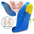 thumbnail image 3 of Plantillas ortopédicas para niños, plantillas para pies planos, corrección del arco, cuidado de los pies para niños, plantillas ortopédicas, plantillas para zapatos, 3 of 5