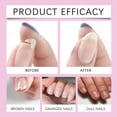 thumbnail image 5 of Cuticle Oil For Nails Pineapple Jojoba Nail Oil With Vitamin- Moisturizes Repairs And Promotes Nail Growth - Prevents Dryness Hangnails And Chap 15ml, 5 of 8