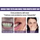 thumbnail image 3 of Pasta de dientes morada blanqueadora de dientes Jaysuing, 3 of 10