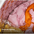 thumbnail image 2 of Whirlpool 4.5 Cu. Ft. Top-Load Washer with 360 Wash Agitator and Built-In Water Faucet, 2 of 6